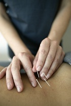 Acupuncture Scottsdale Chinese Medicine Chambers Clinic