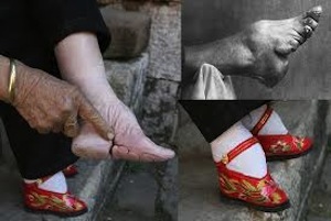 Chinese foot binding