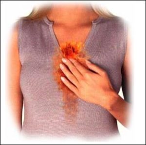 heartburn body image