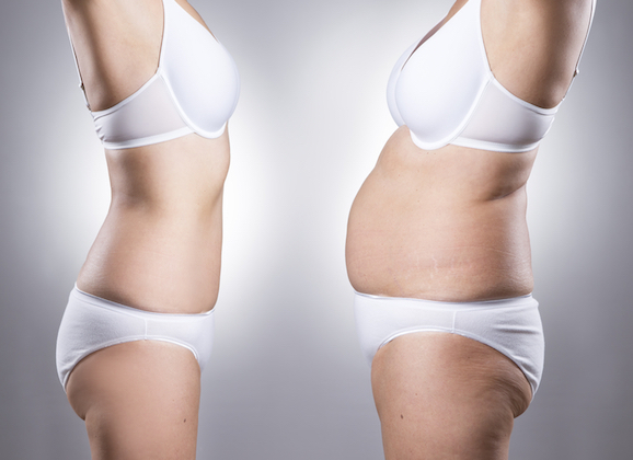 How Body Shaming Has Taken On A New Shape